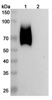 Recombinant Human CD66a/CEACAM1 Protein, C-His