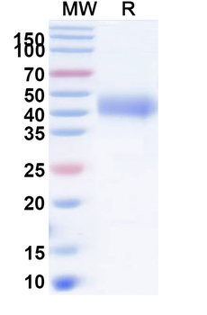 Recombinant Human TFPI Protein, C-His