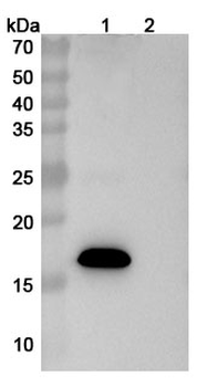 Recombinant Human APP Protein, N-His