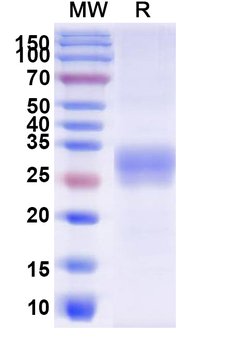 Recombinant Human CD32/FCGR2A Protein, C-His