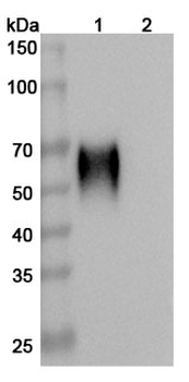 Recombinant Human CD200R1/OX2R Protein, C-His