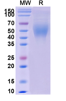 Recombinant Human CD200R1/OX2R Protein, C-His