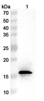 Recombinant Monkeypox virus/MPXV A29L Protein, C-His