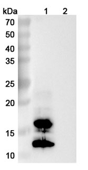 Recombinant Monkeypox virus/MPXV A29L Protein, C-His