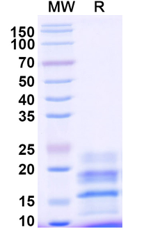 Recombinant Monkeypox virus/MPXV A29L Protein, C-His