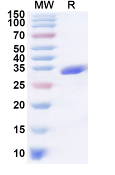Recombinant Staphylococcus aureus entB/SEB Protein, C-His
