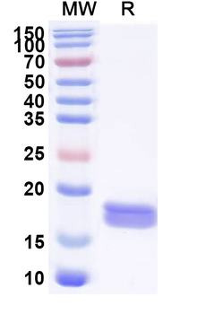 Recombinant Human LC3B/MAP1LC3B Protein, N-His