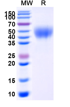 Recombinant Human CD158a/KIR2DL1 Protein, C-His