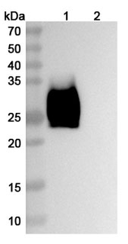Recombinant Human CD147/BSG Protein, C-His