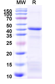 Recombinant Human DKK3 Protein, N-His