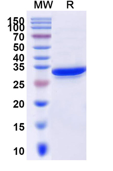 Recombinant Human ATG5 Protein, N-His