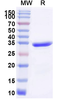 Recombinant Human ATG5 Protein, N-His