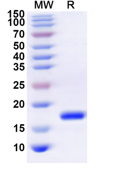 Recombinant Human IL22 Protein, N-His