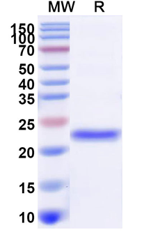 Recombinant Human TRPV1 Protein, N-His