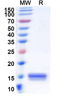 Recombinant Human CD218a/IL18R1 Protein, N-His
