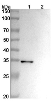 Recombinant Human CD156b/ADAM17 Protein, N-His