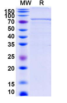Recombinant Human STAT1 Protein, N-His