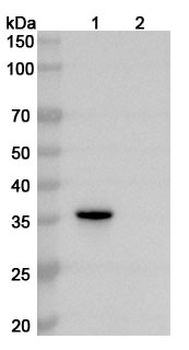 Recombinant Human VDAC1 Protein, N-His