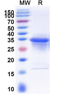Recombinant Human VDAC1 Protein, N-His