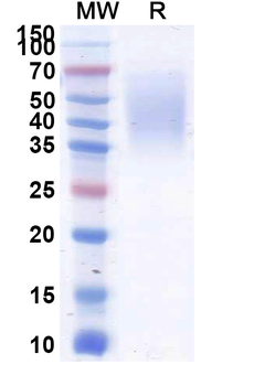 Recombinant Human CD58/LFA3 Protein, C-His
