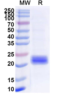 Recombinant Human GLUT4/SLC2A4 Protein, N-His-SUMO