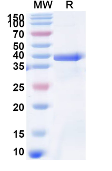 Recombinant Human COL6A2 Protein, N-His