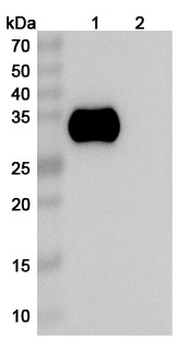 Recombinant Human CD2 Protein, C-His