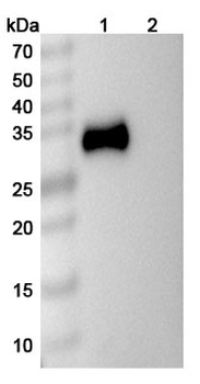 Recombinant Human CD2 Protein, C-His