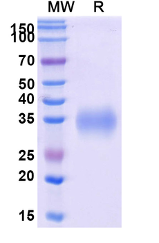 Recombinant Human CD2 Protein, C-His