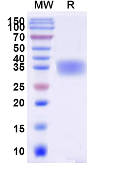 Recombinant Human EPO Protein, C-His