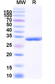Recombinant Human CD254/RANKL/TNFSF11 Protein, N-His