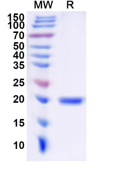Recombinant Human UBE2C Protein, N-His
