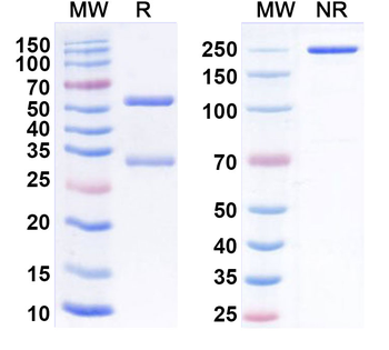 LPL/LIPD Mouse Monoclonal Antibody