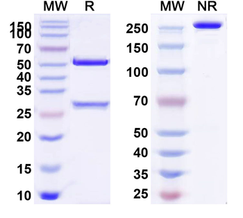 CD365/KIM-1/TIM-1/HAVCR1 Mouse Monoclonal Antibody