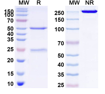 CD254/RANKL/TNFSF11 Human Monoclonal Antibody