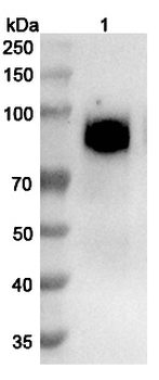 CD140a/PDGFRA Human Monoclonal Antibody
