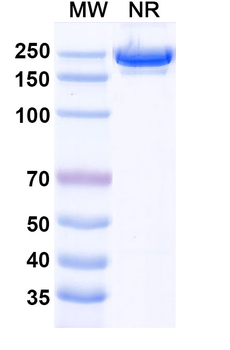 CD126/IL6R/IL-6RA Human Monoclonal Antibody