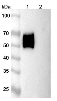 CD116/CSF2RA Human Monoclonal Antibody