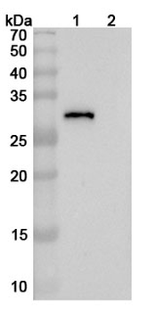 SARS-CoV-2 RBD Human Monoclonal Antibody