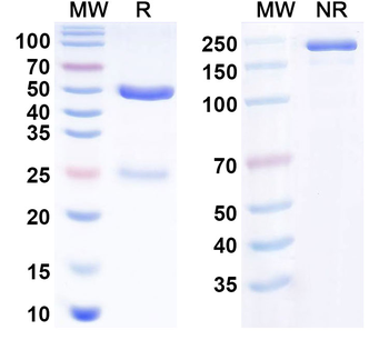 CD126/IL6R/IL-6RA Human Monoclonal Antibody