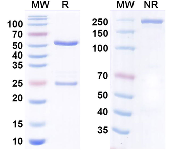 DCBLD2/ESDN Human Antibody
