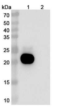 Pacibekitug Human Monoclonal Antibody