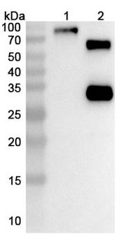Bexatamig Human Monoclonal Antibody