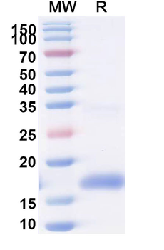 HIV1 gp120/Glycoprotein 120 & CD4 Human Monoclonal Antibody