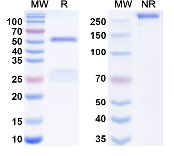 HIV1 gp120/Glycoprotein 120 & CD4 Human Monoclonal Antibody