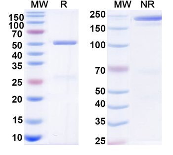 HBsAg Human Monoclonal Antibody