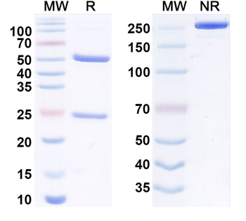 CD120b/TNFRSF1B/TNFR2 Human Monoclonal Antibody