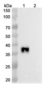 Sotiburafusp Alfa Human Monoclonal Antibody