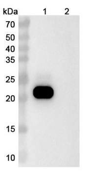 Vamikibart Human Monoclonal Antibody