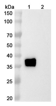 Retlirafusp Alfa Human Monoclonal Antibody